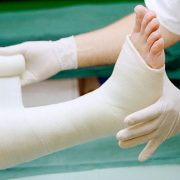 Broken A Bone? Take A Look At These Natural Remedies