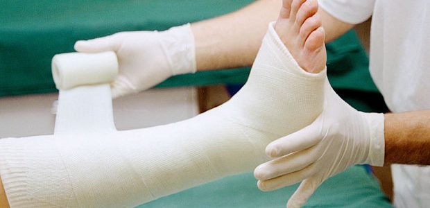 Broken A Bone? Take A Look At These Natural Remedies