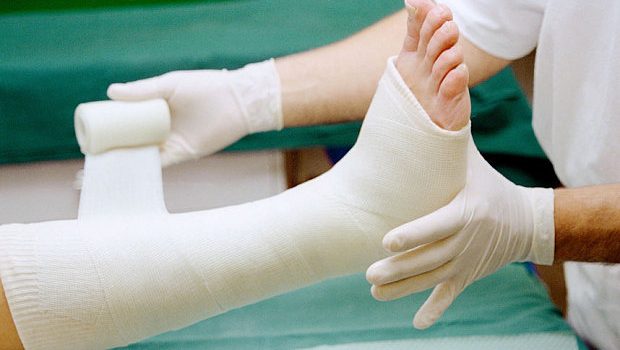 Broken A Bone? Take A Look At These Natural Remedies