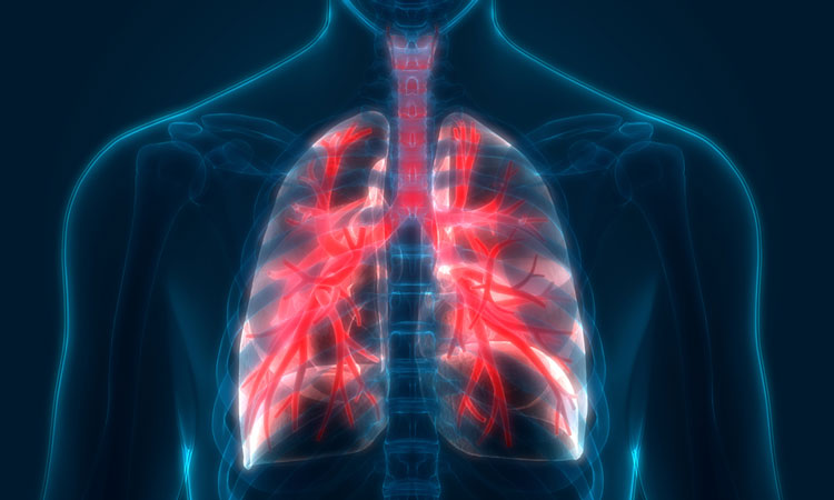 Are You Living with the Signs and Symptoms of COPD?