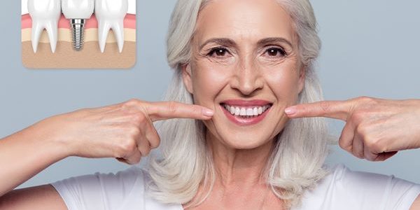 ¿Podrían Los Implantes Dentales Ayudar a Perfeccionar su Sonrisa?