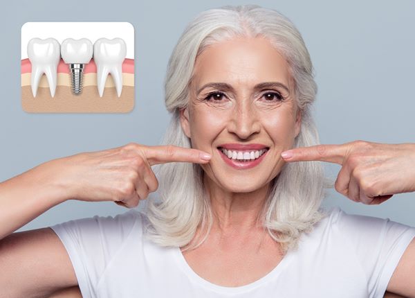 ¿Podrían Los Implantes Dentales Ayudar a Perfeccionar su Sonrisa?